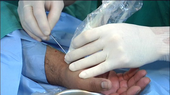 04_01_12_operacion_mano